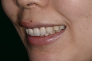 自由診療と予防歯科