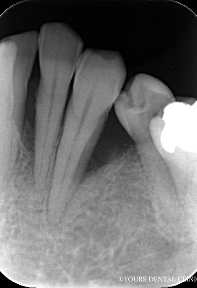 ユアーズデンタルクリニックの考える歯周病の治療とは