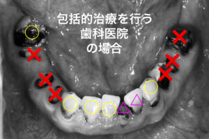 札幌、歯医者、自費治療、歯の保存、インプラント、矯正治療